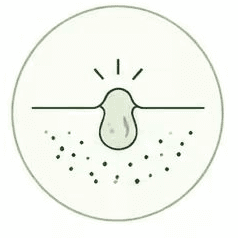 Acne & Congestion
