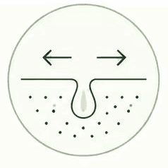 Enlarged Pores